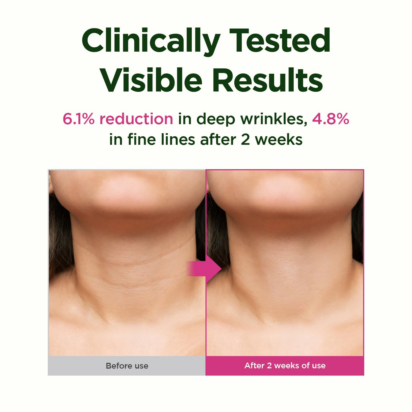 CKDE 🎉（🎇Retino Collagen Gua Sha Neck Cream - Firming Cream for Neck and Jawline Tightening.🎇）1.69 fl oz.