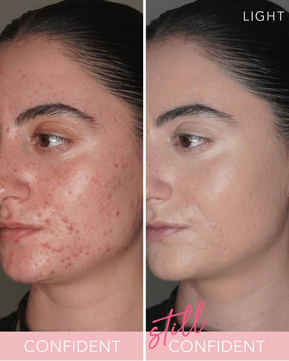 T.C.E Super Coverage 🛡️ Serum 💧 Makeup with Peptides 🔬 Concealer Foundation 💄