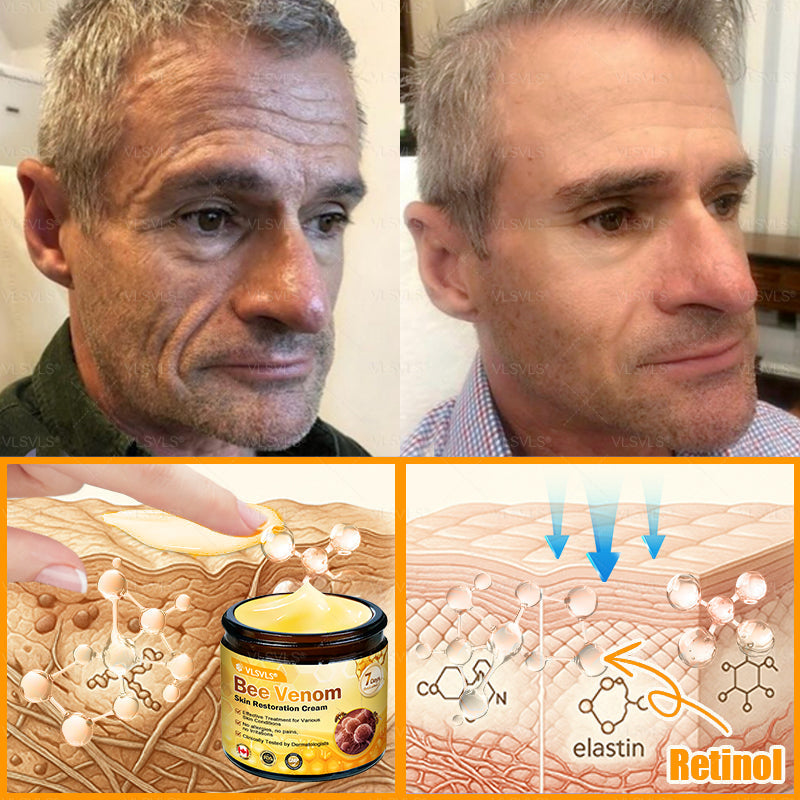 Made and Shipped from Canada 🎁 VLSVLS® Bee Venom Skin Restoration Cream 🔥 LAST DAY 80% OFF