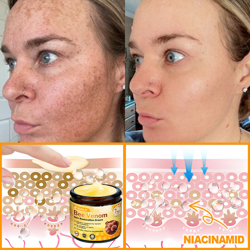 Made and Shipped from Canada 🎁 VLSVLS® Bee Venom Skin Restoration Cream 🔥 LAST DAY 80% OFF