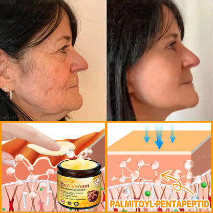 Made and Shipped from Canada 🎁 VLSVLS® Bee Venom Skin Restoration Cream 🔥 LAST DAY 80% OFF