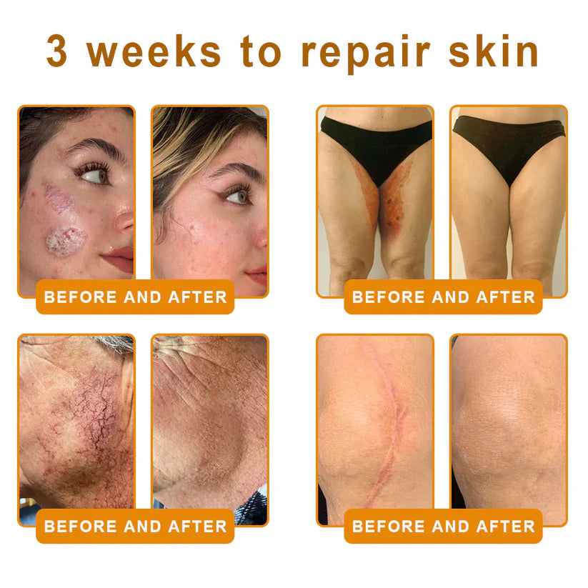 Made and Shipped from Canada 🎁 VLSVLS® Bee Venom Skin Restoration Cream 🔥 LAST DAY 80% OFF