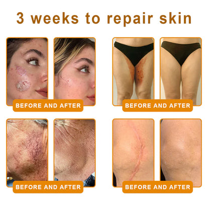 Made and Shipped from Canada 🎁 VLSVLS® Bee Venom Skin Restoration Cream 🔥 LAST DAY 80% OFF