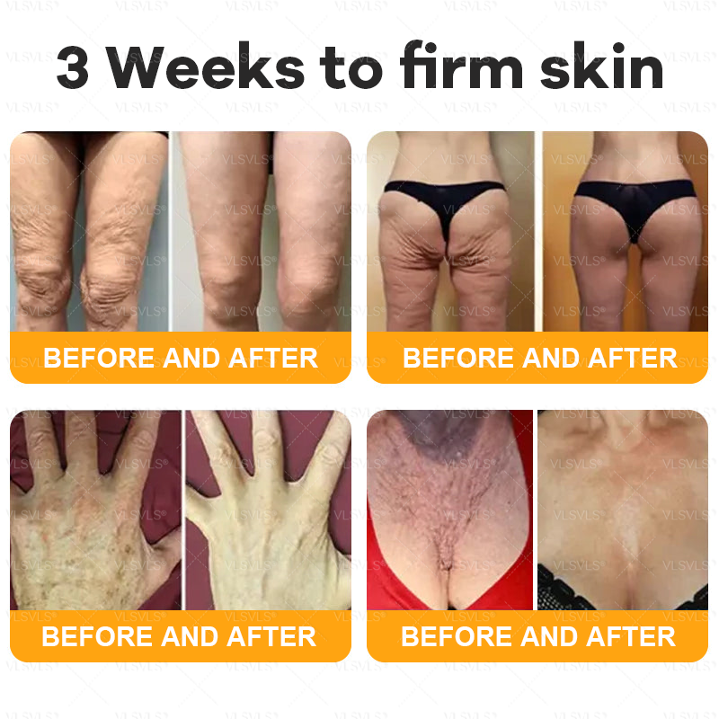 Made and Shipped from Canada 🎁 VLSVLS® Bee Venom Skin Restoration Cream 🔥 LAST DAY 80% OFF