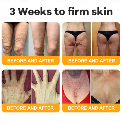 Made and Shipped from Canada 🎁 VLSVLS® Bee Venom Skin Restoration Cream 🔥 LAST DAY 80% OFF