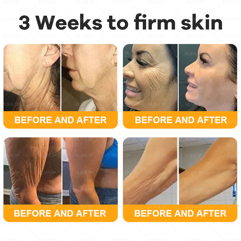 Made and Shipped from Canada 🎁 VLSVLS® Bee Venom Skin Restoration Cream 🔥 LAST DAY 80% OFF