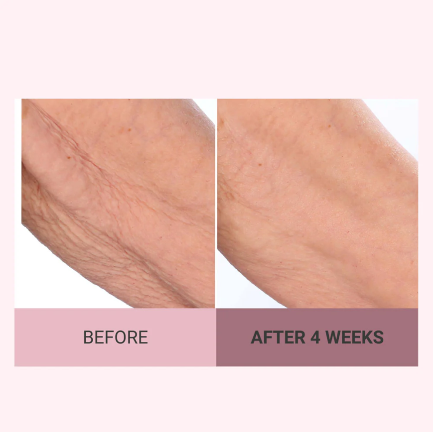 💆‍♀️ Experience Ultimate Luxury - 50% OFF - ✨ Champagne Beaute Lift Firming Body Crème - For Firmer, Smoother, Radiant Skin! 🌟（Buy 3 & Free Shipping）