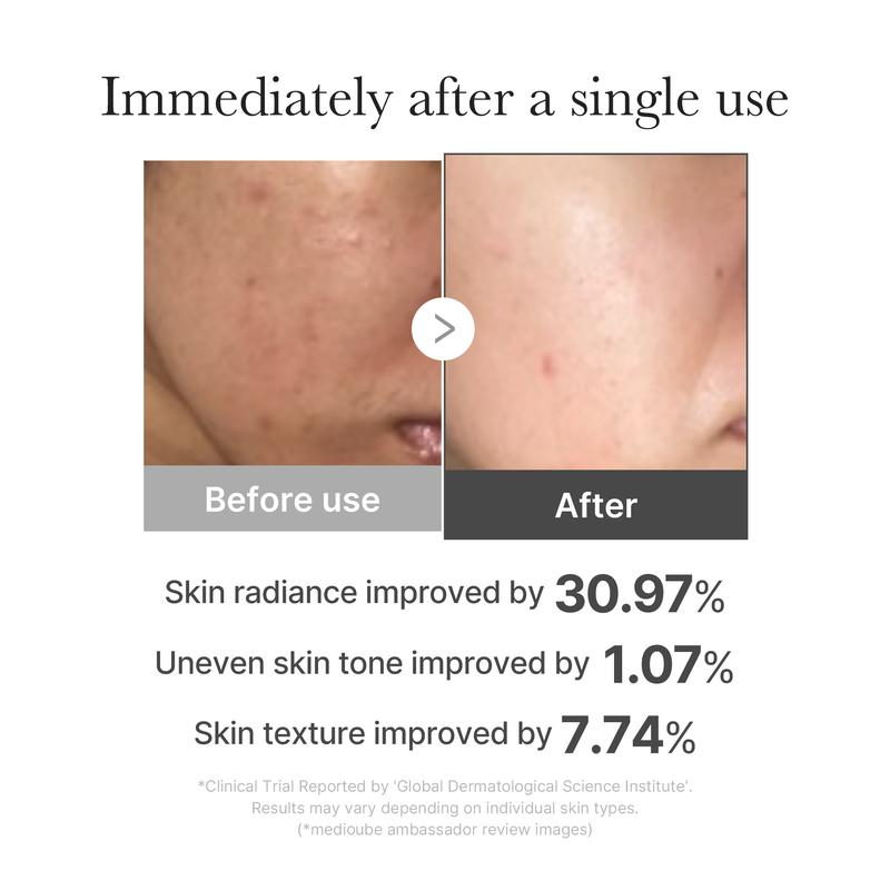 [medioube] MINI Booster Pro | K-beauty Affordable Device for After Spot & Soothing Care, Portable, Beginner-friendly, Clear Glass Glow Skin